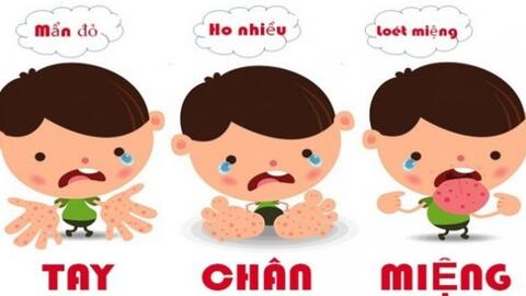 Ngừa biến chứng bệnh tay chân miệng