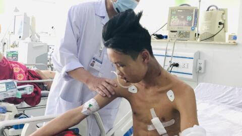 CỨU SỐNG BỆNH NHÂN BỊ ĐA CHẤN THƯƠNG, DỊCH TRÀN NGOÀI MÀNG TIM GÂY CHÈN ÉP TIM